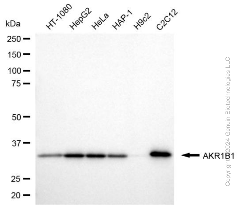 WB - KD-Validated Anti-AKR1B1 Mouse Monoclonal Antibody AGI1973